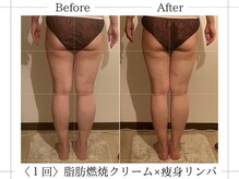 アルム(ALUM)/浮腫みやすい梅雨時期にオススメ