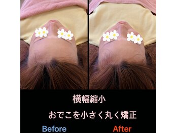 美容矯正サロン レレポノ(LELEPONO)/