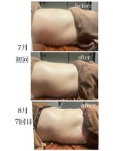 イーストモア(EAST MOIS)/夏は代謝が下がる季節でも変化