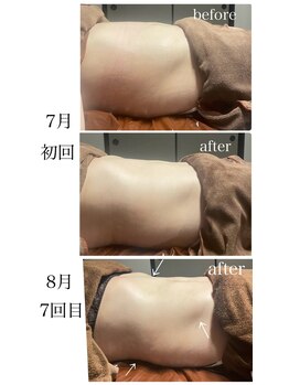 イーストモア(EAST MOIS)/夏は代謝が下がる季節でも変化