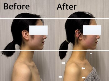 ベール(BEHL)/コルギのBefore After