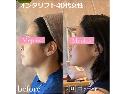 ミープラス(Me+)の写真