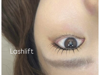 ピークアイ(Peek eye)の写真