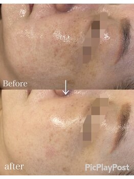 エステドブルー(Este de Bleu)/ビフォーアフター