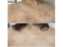 リセラージュ(Recellage)/【よもぎ蒸し】乳菌美人蒸し