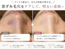 スコビ(SUKOBI)の雰囲気（ホームケアと一緒にケアすることで美肌スピードは加速☆）