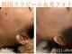 グレイティア(gratia)の写真