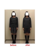 プリンセス バイ セイフティプリンセス 長野店(PRINCESS)/《猫背・反り腰に》全身矯正