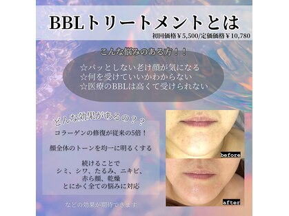 アミオ(amio)の写真
