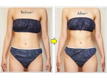 エムネージュ(M neige)/