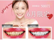 エクシアホワイトニング 石巻店