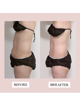 ミーティス/50代のお客様♪