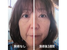 ティーボックスボーテ(TBOX beaute)/