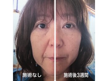 ティーボックスボーテ(TBOX beaute)/