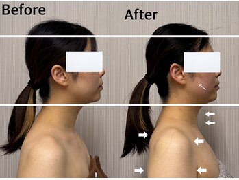 ベール(BEHL)/コルギのBefore After