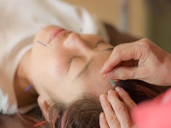 はるもにあ/美容鍼