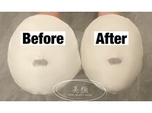 美極 トータルビューティー(美極 TOTAL BEAUTY)/恵比寿/小顔コルギ/エステ/