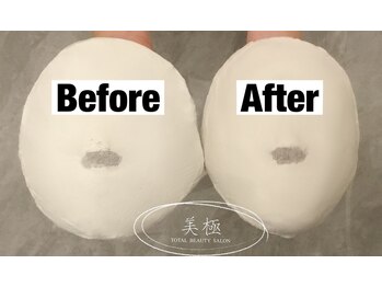 美極 トータルビューティー(美極 TOTAL BEAUTY)/恵比寿/小顔コルギ/エステ/