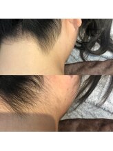 ディライト 名古屋駅店(Delight)/あなたのうなじ整えます