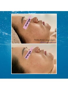 サロンドボーテ オランジュ(salon de beaute Orange)/タラソトリートメント