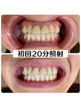 ヘアーサロン レーヌ(hair salon rEINE)/