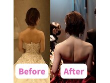 ボディキュア ブライダル美容整体 大阪梅田/姿勢で変わるドレス姿★/大阪