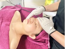 キキ(KiKi)/プラズマフェイシャルで根本美肌