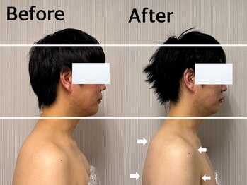 ベール(BEHL)/コルギのBefore After