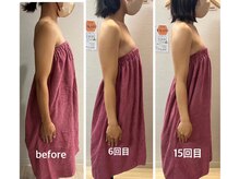 ロココ 豊田店(Rococo)/ビフォーアフター