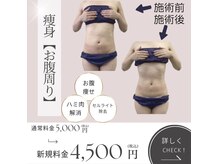 ミルティー(Myrtille)