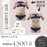 ミルティー(Myrtille)