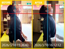 整体院 元 くまなん店/首の痛みや肩のハリの悩み