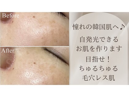 エステサロン シュールの写真