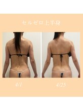 ビューティー アディクト(Beauty addict)/イベントに向けて短期間集中！