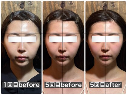 シャインミー 新宿店(Shine me)の写真