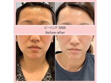 ディアメ(Diame)/くすみ・毛穴トラブルにはこれ！