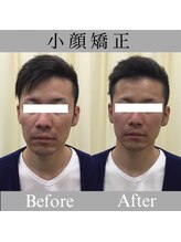 プリンセス バイ セイフティプリンセス 長野店(PRINCESS)/《男性にも人気》小顔矯正