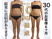 サロン ド ボーテ ラーンジュ 岐阜店(salon de beaut'e L'ange)/ハイパ-ナイフEX2ダイエット痩身