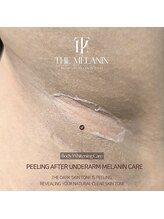 エクスクラメーションマーク(!!!)/メラニンケア