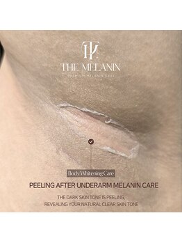 エクスクラメーションマーク(!!!)/メラニンケア