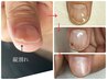【Hand】割れる爪、剥離爪にお悩みの方☆　9800円→7800円　※10月迄　60分