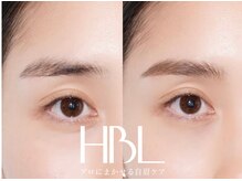 リンネ(Rinne)/【HBL】before/after