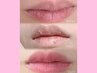 【 黒ずみケアの新常識◆ローマピンク 】 唇　（リップ）＊ 40%OFF