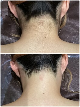 アンジュヴィバラヴィーダ(Ange viva la vida)の写真/初めての脱毛大歓迎◎全箇所自己処理不要なので剃り方が分からない方、、Angeに全てお任せ下さい！