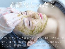 ボニータアンジュ 恵比寿(Bonita Ange)/ハーブピーリングの流れ７