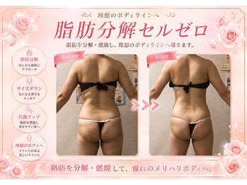 エステティックサロン フェアリー(ESTHETIC SALON FAIRLY)/痩身