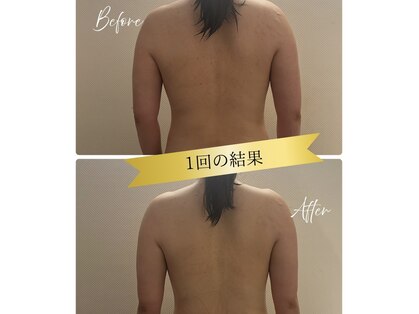 ジェーピーユキノ(jp.yukino)の写真