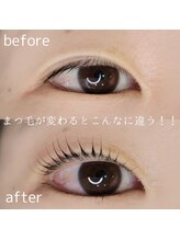 シルミエ(cilumie)/次世代ラッシュリフト