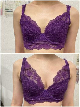 バーディー(BIRDIE)/施術3回/４０代/B→C