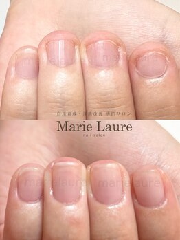 マリーロール 淀屋橋本店(Marie Laure)/自爪育成/深爪矯正/ネイルケア